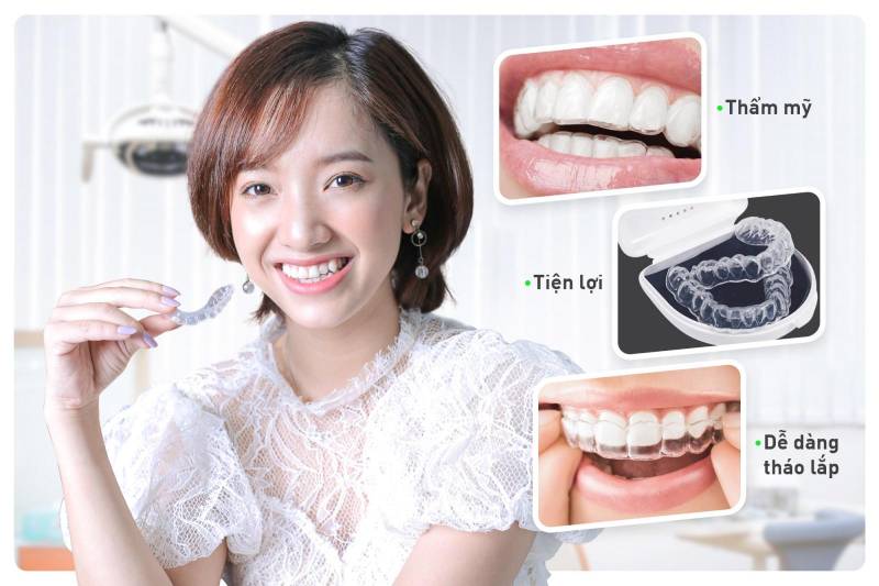 Thiên Hà - Địa chỉ niềng răng invisalign uy tín hiện nay