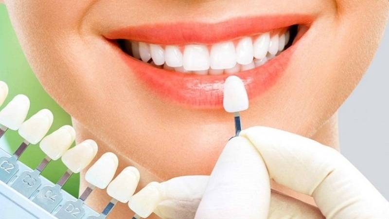Răng sứ sẽ không bị đổi màu, không bị xỉn, ố vàng hoặc xuống màu như răng tự nhiên